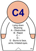 C4 patient frontw